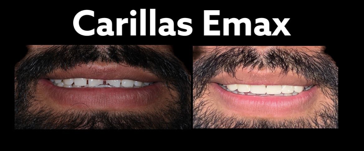 Andrés Vicente Reyes-0