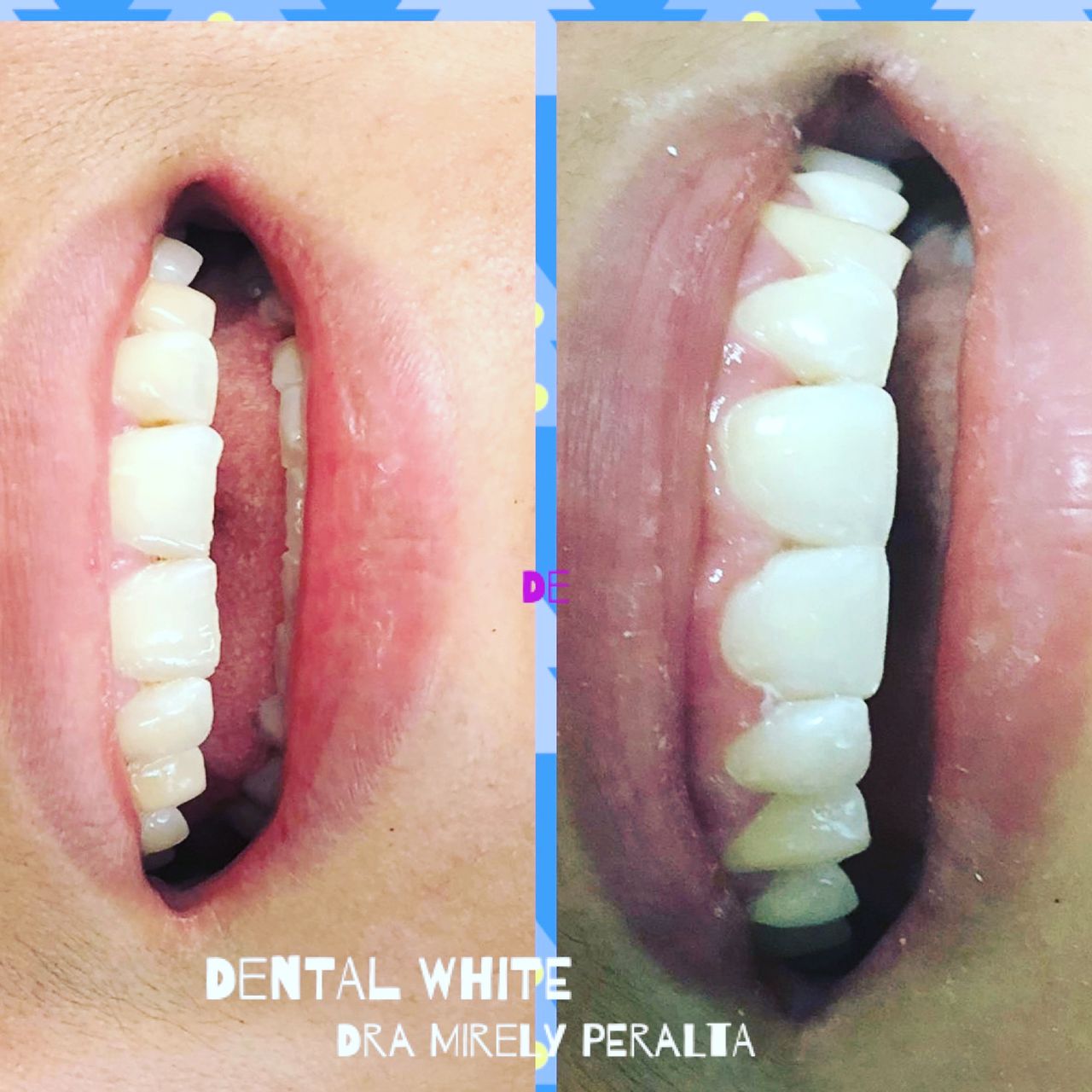 Mirely Peralta Rodríguez-9