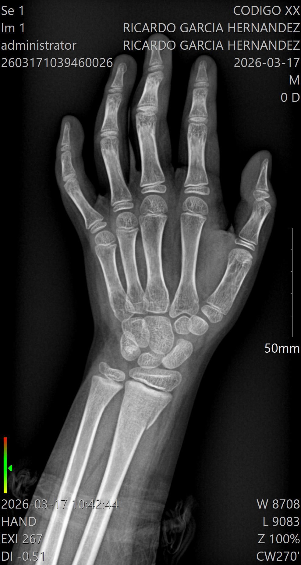 Alejandro Irisson-11