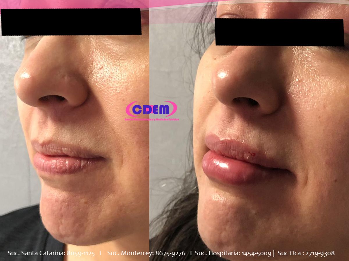 Mercedes Fernández Reyes-20