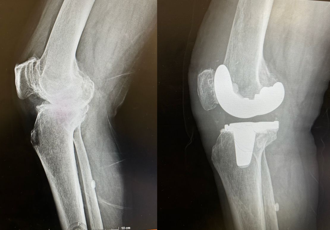 Diego Armando Contreras Rojas-21