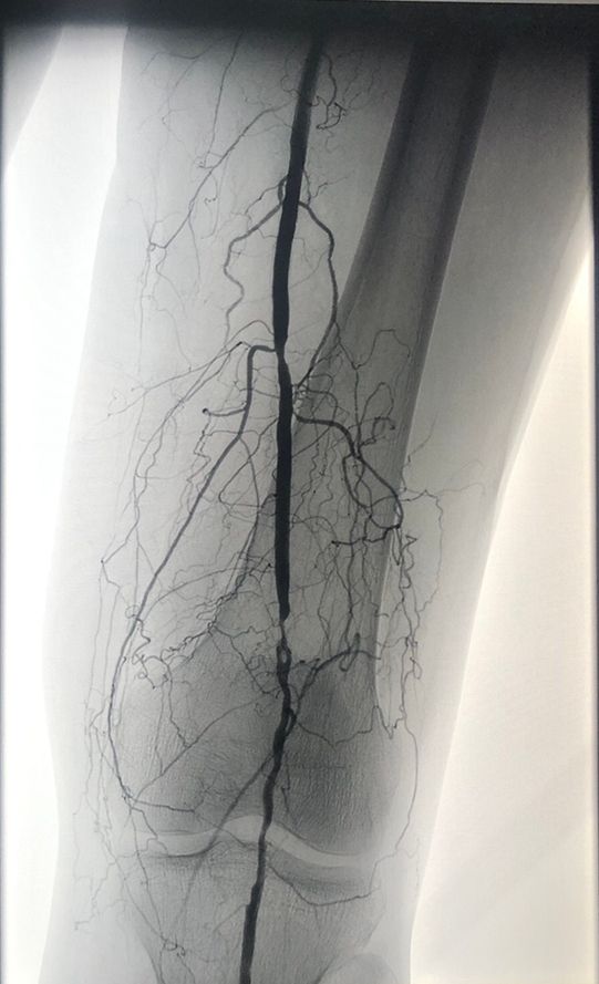 Miguel Abraham Lara Perez-7