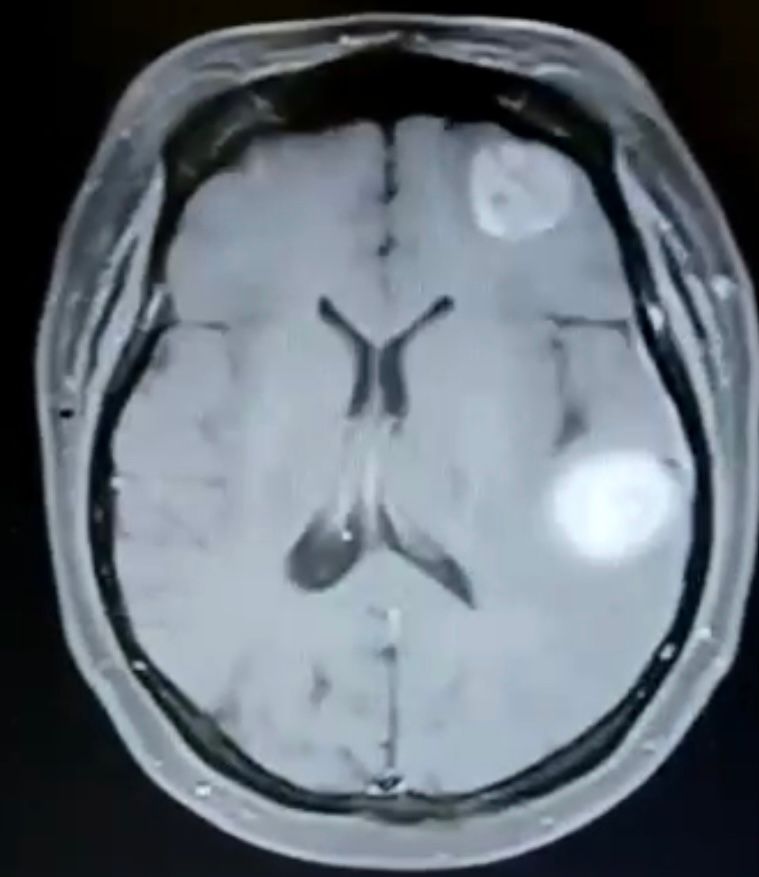 Gustavo De Jesús Parra Romero-18