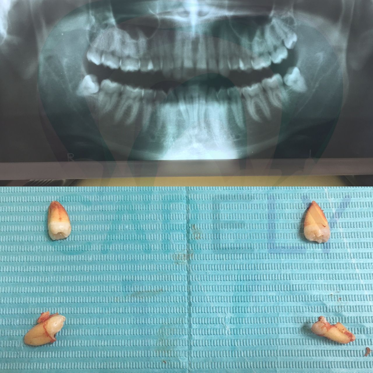 Carlos Candelaria Margarito-10