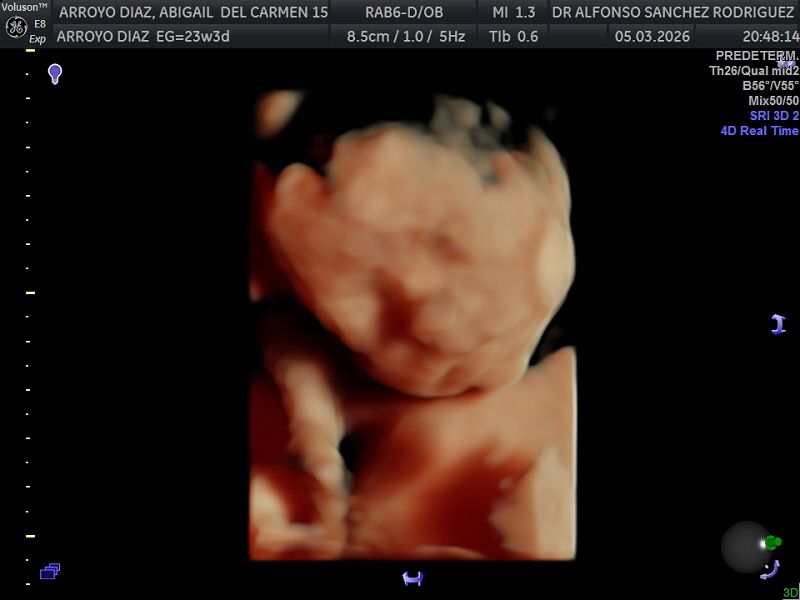 Alfonso Sanchez Rodriguez-63