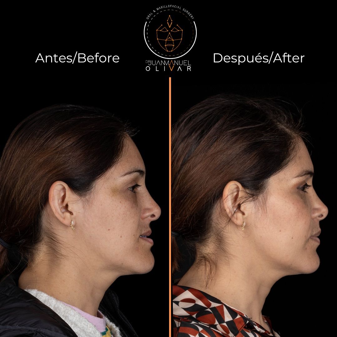 Juan Manuel Olivar Cedeño-6