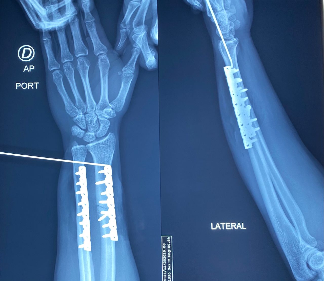 Ana Luisa Bravo Mercado-3