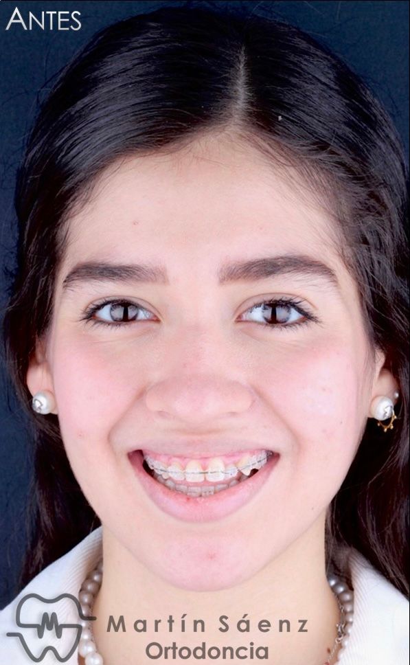 Martín Sáenz Zárate-10