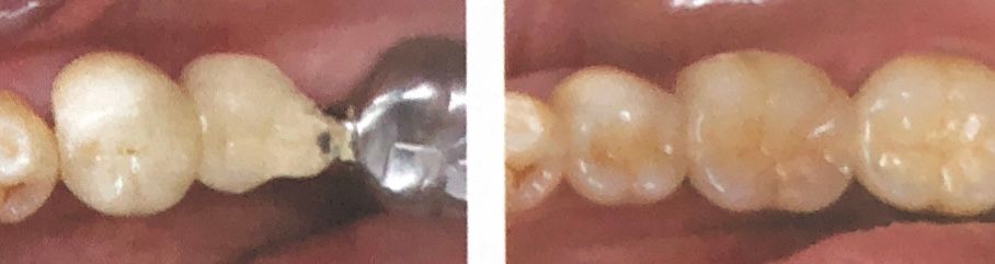 Angel Hermes Aguilar Orihuela-2