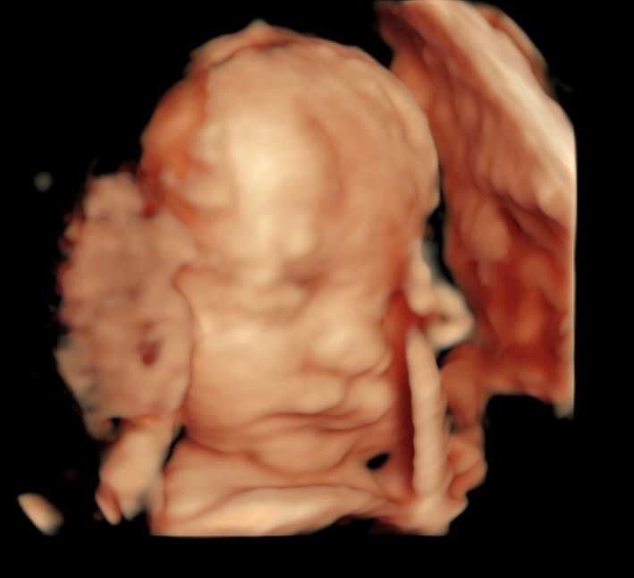 Juan Carlos De León-9