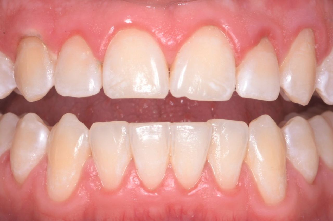 Leonardo Hernández Fernández-3