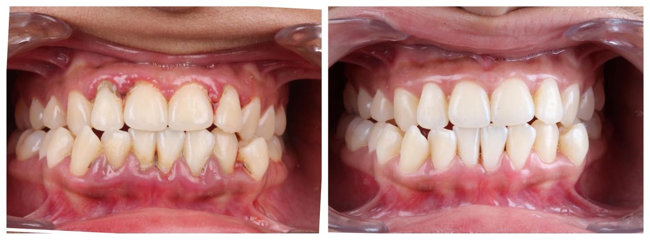 Hugo Enrique Aguilar Lamas-94