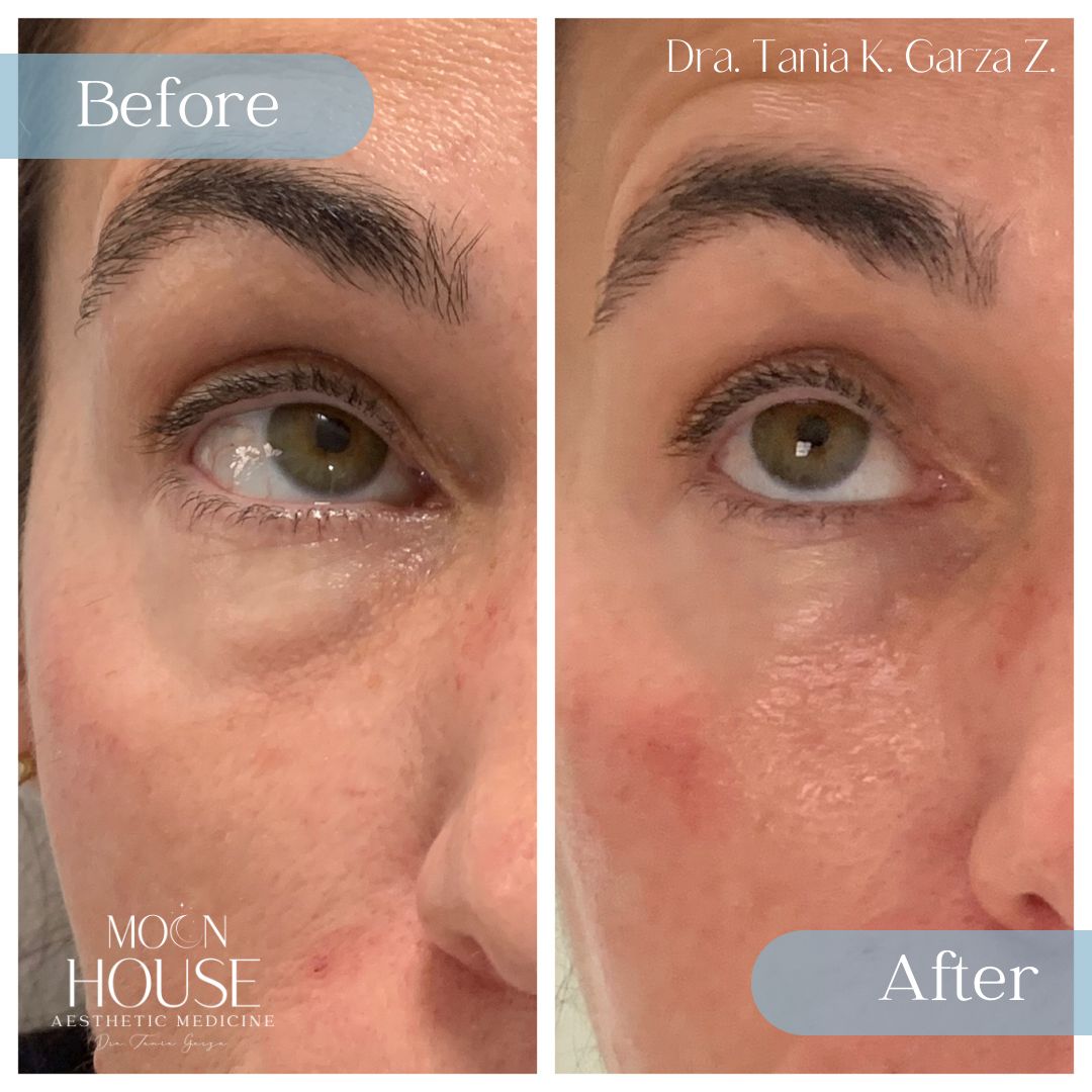 Tania Karine Garza Zepeda-12