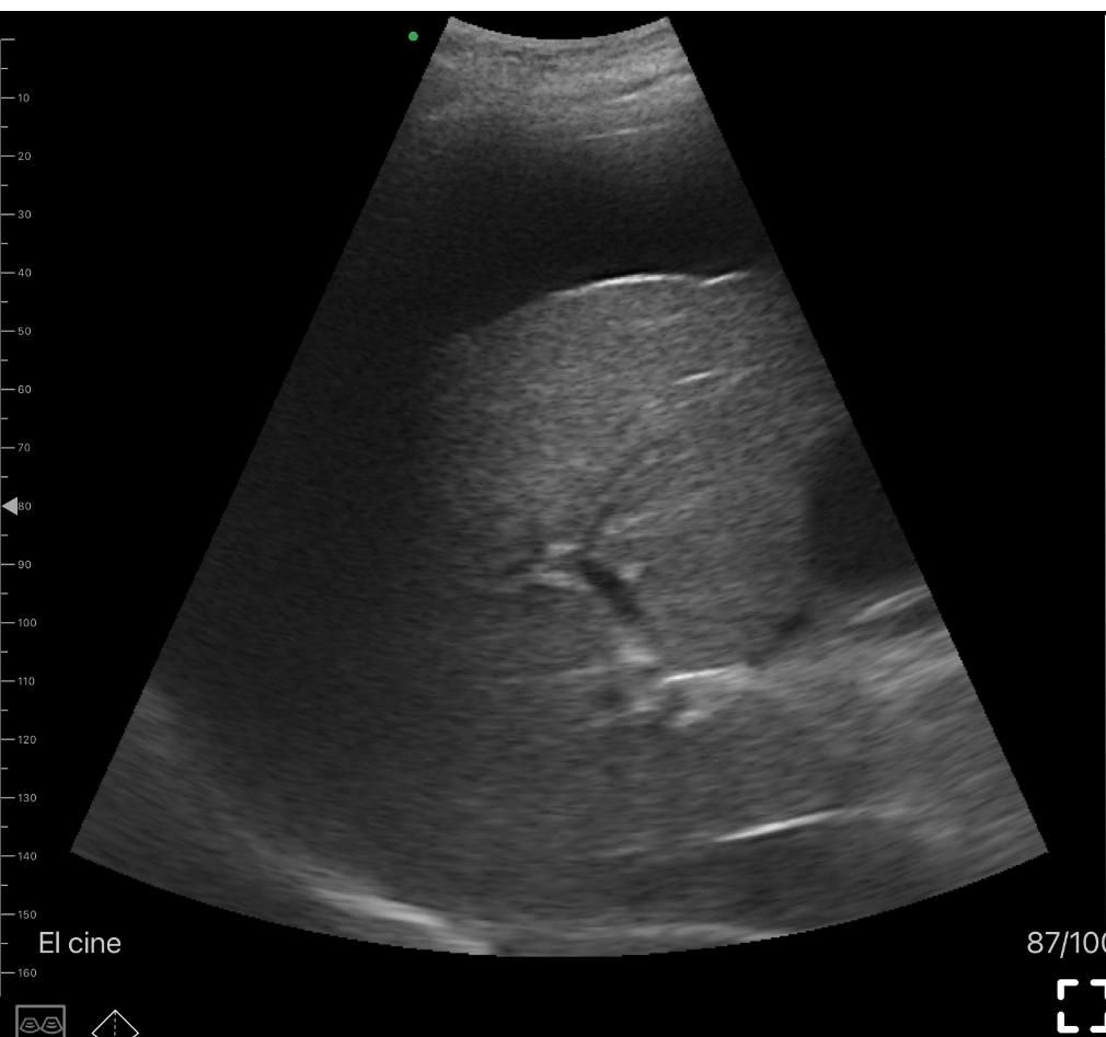 Juanita Pérez Escobar-6