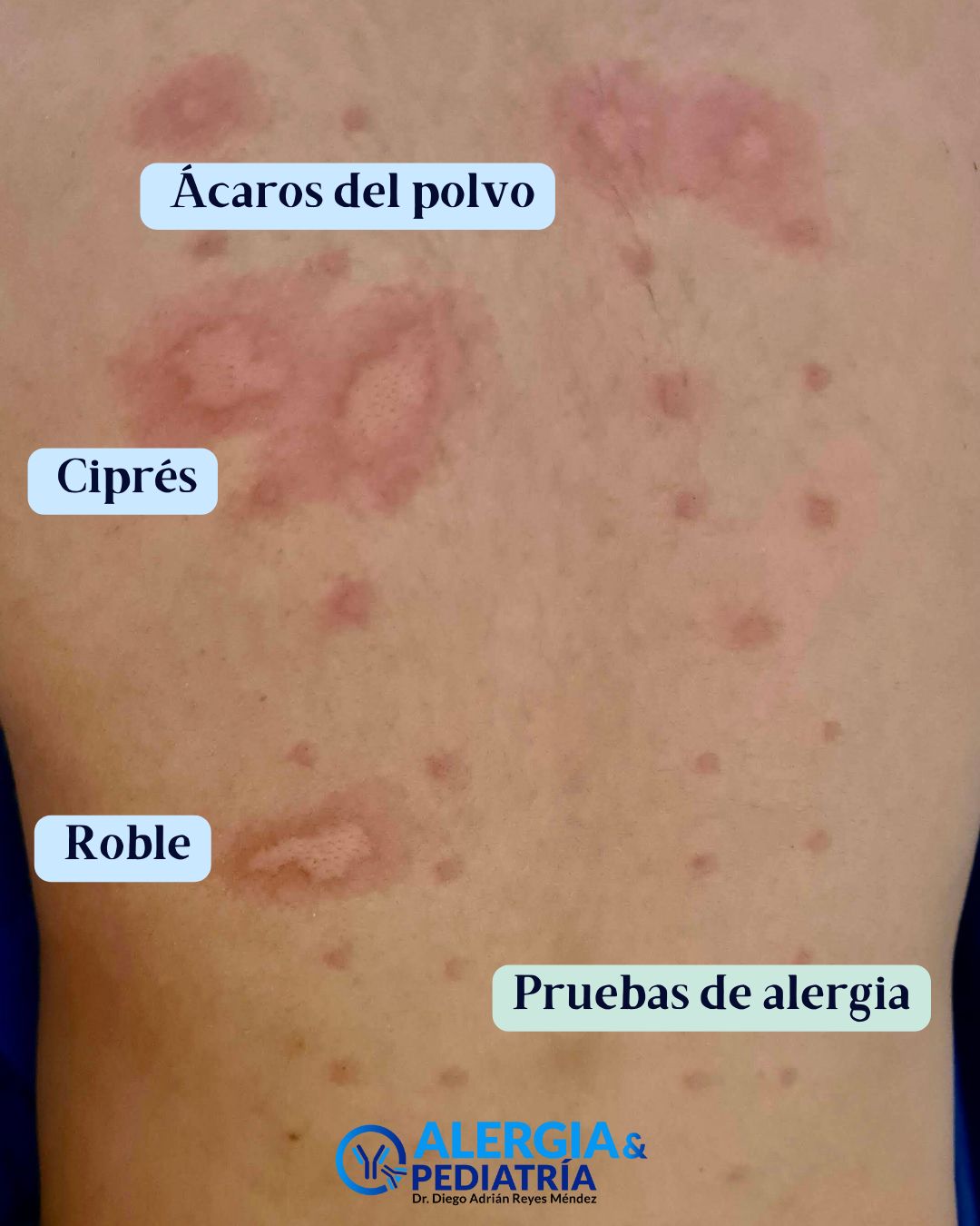 Diego Adrián Reyes Méndez-7