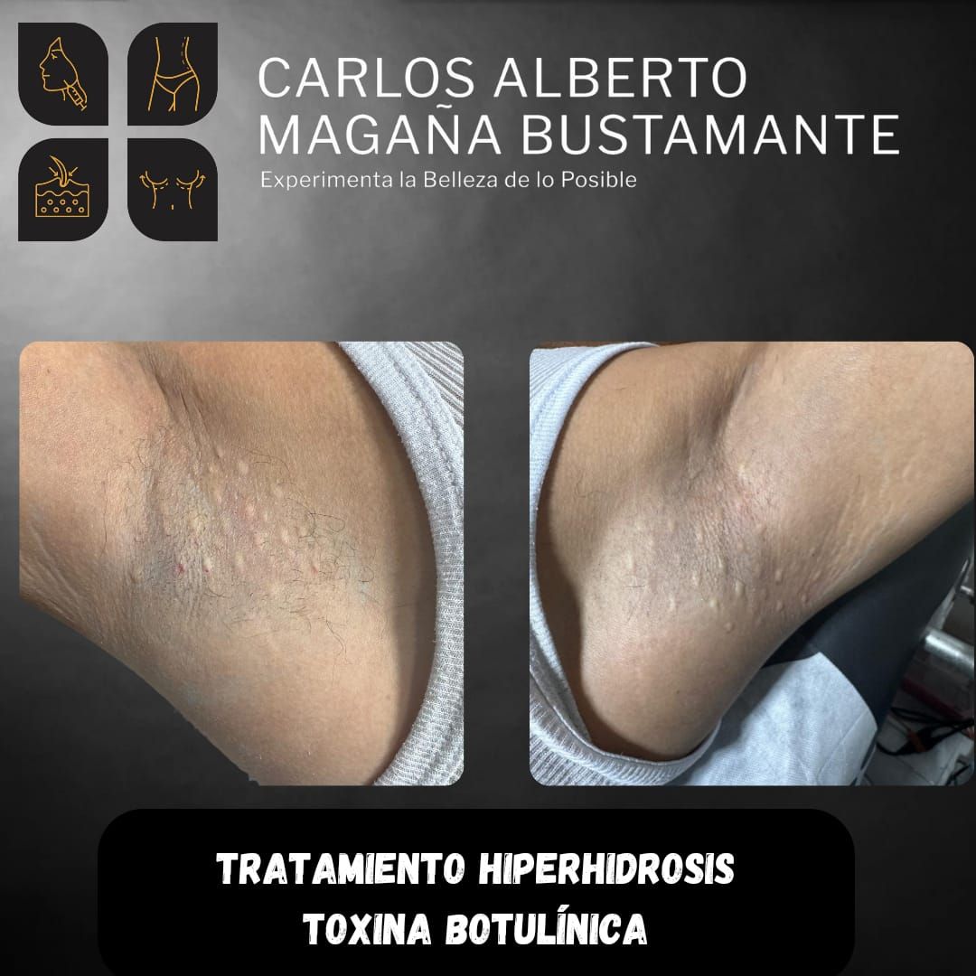 Carlos Alberto Magaña Bustamante-33