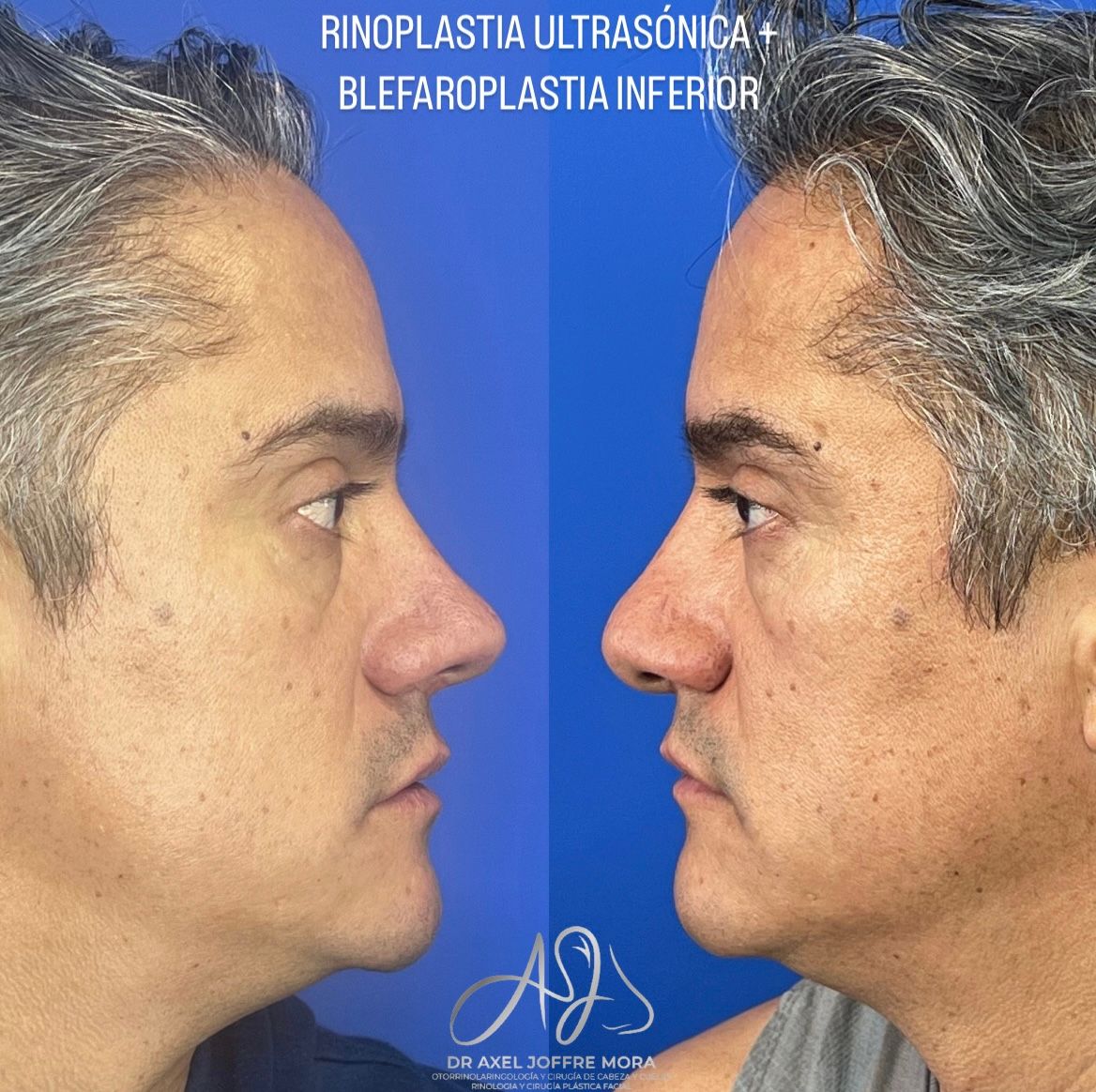 Axel Joffre Mora-3