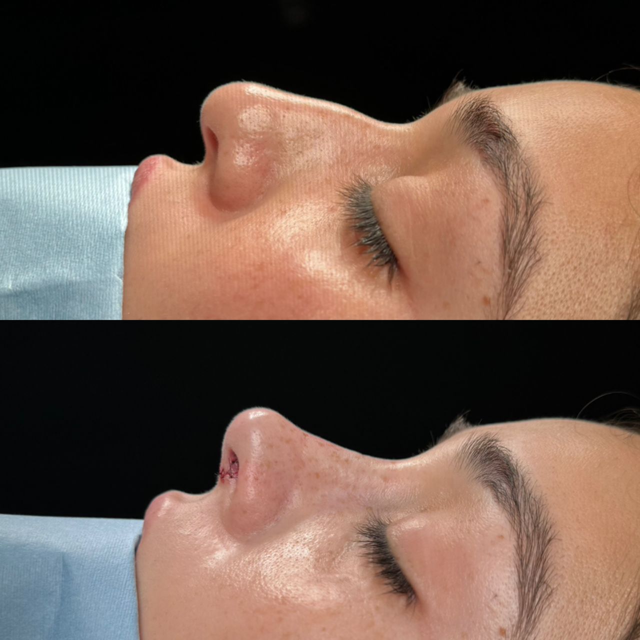 Angel Castro Urquizo-157