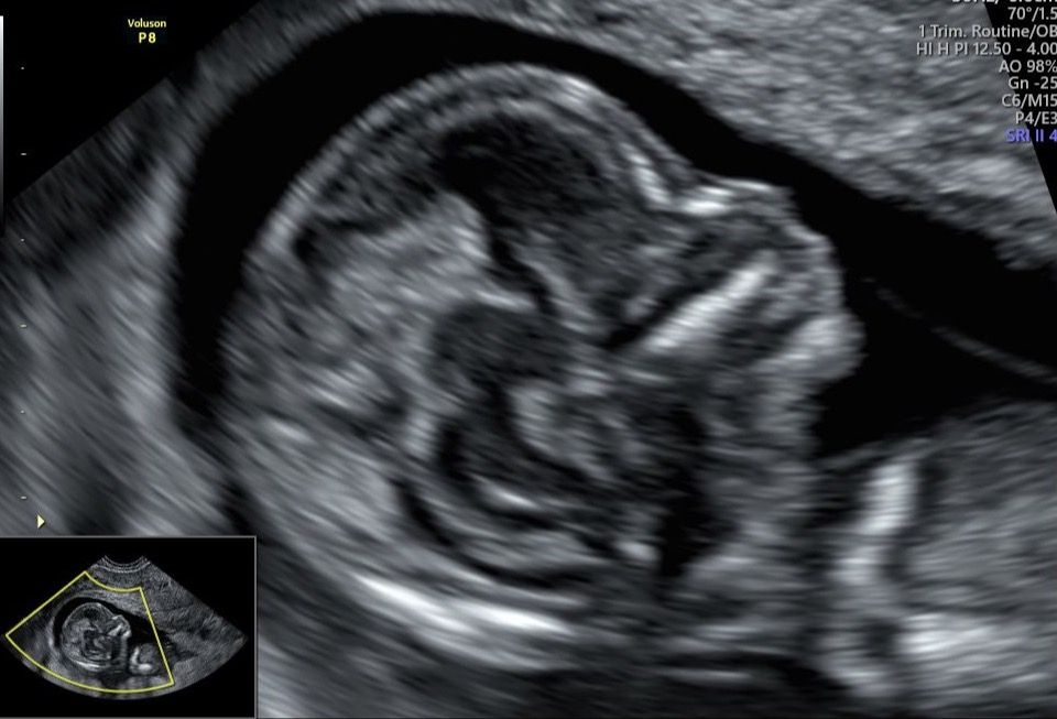 Azael Jiménez Bonola-2