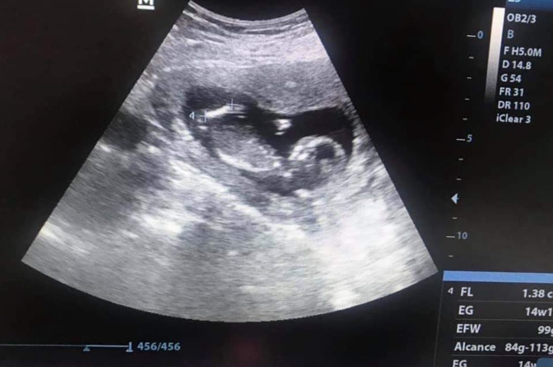 Yelitza De La Luz Ochoa-2