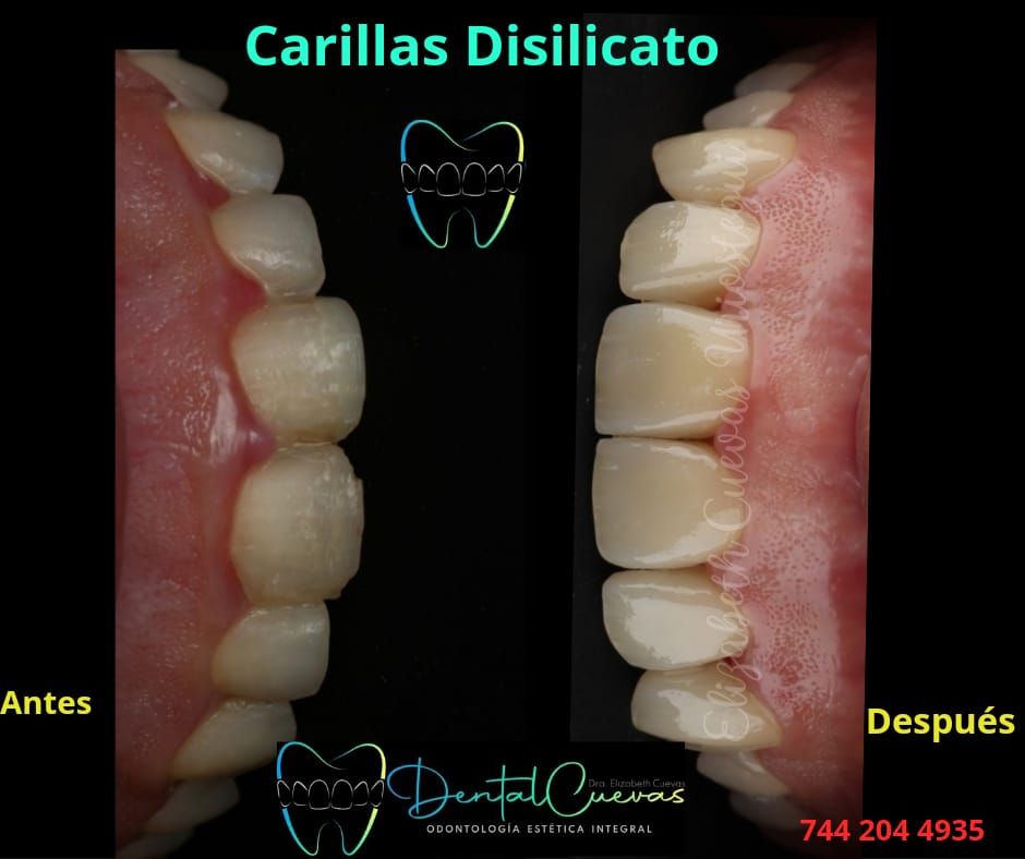 Elizabeth Cuevas Uriostegui-0