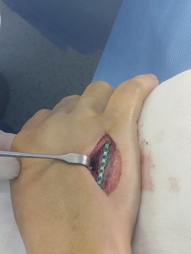 Gisela Cleto Zepeda-150