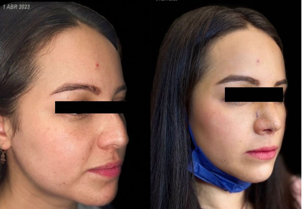 Alvaro Takane Kimura-3