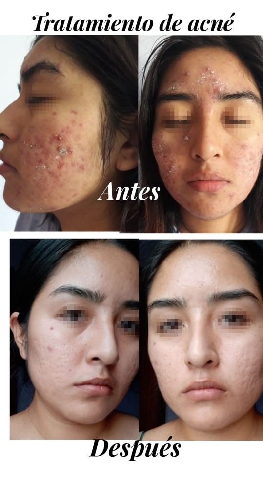 Ana Díaz Noriega-12