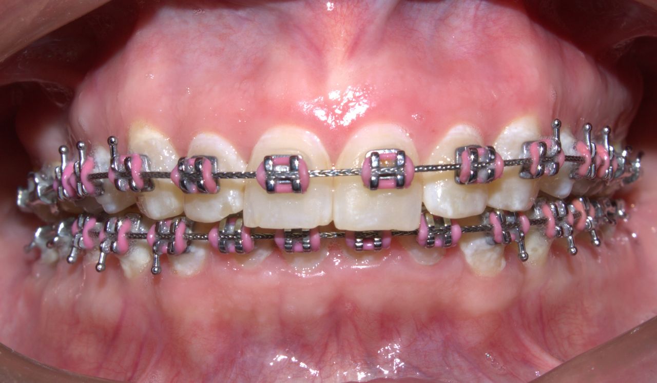 Carlos Ignacio Avila Campos-4