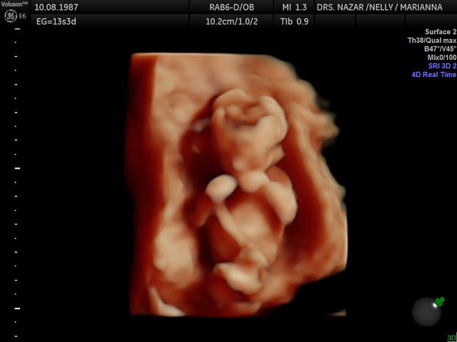 Miguel Angel González Nazar-19