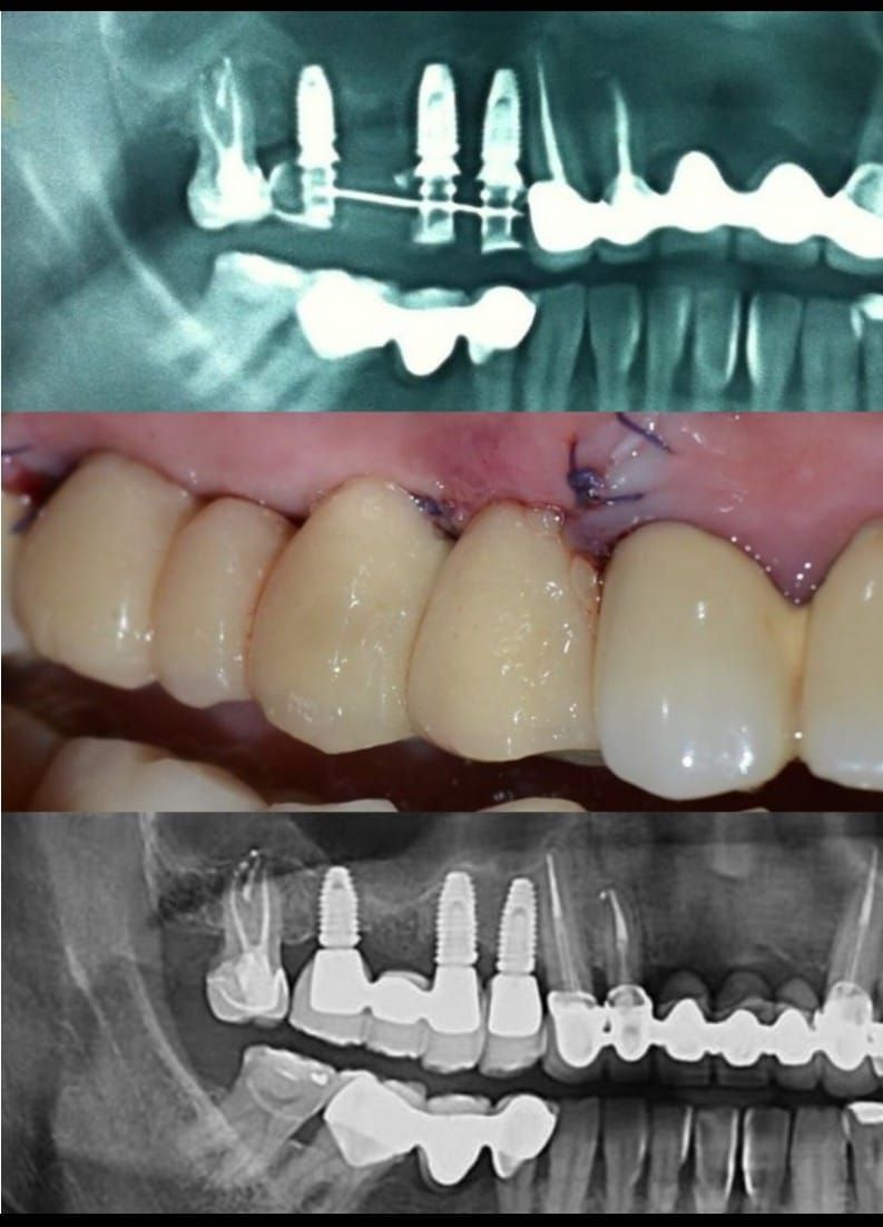 Carlos Ernesto Contreras Castellanos-22
