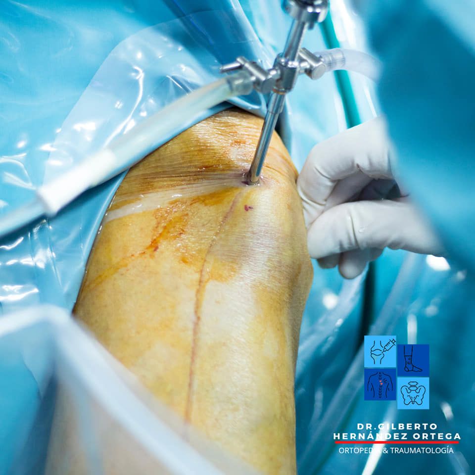 Gilberto Hernández Ortega-29