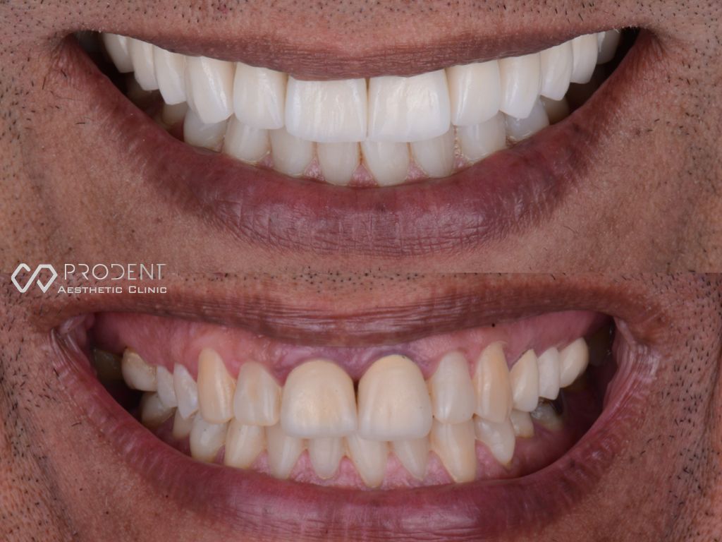 Ramiro Ivan Pérez Murillo-62