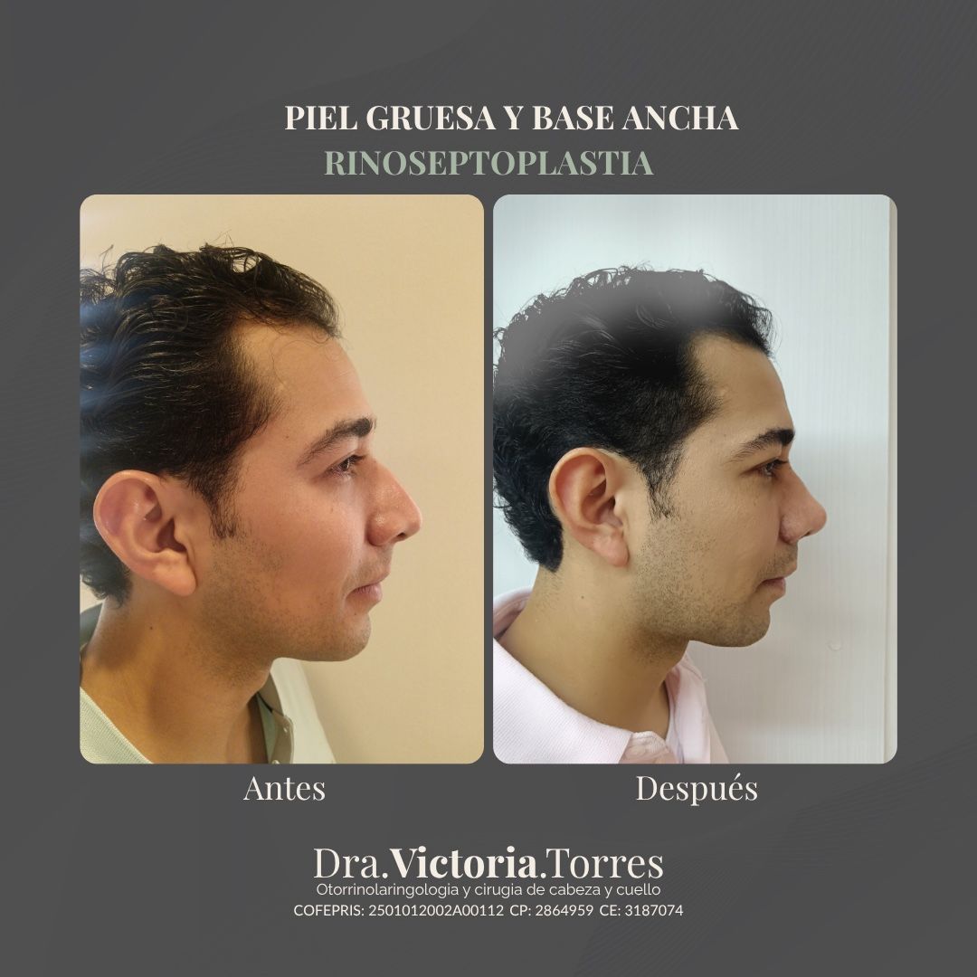 Estela Victoria Torres Galáz-14