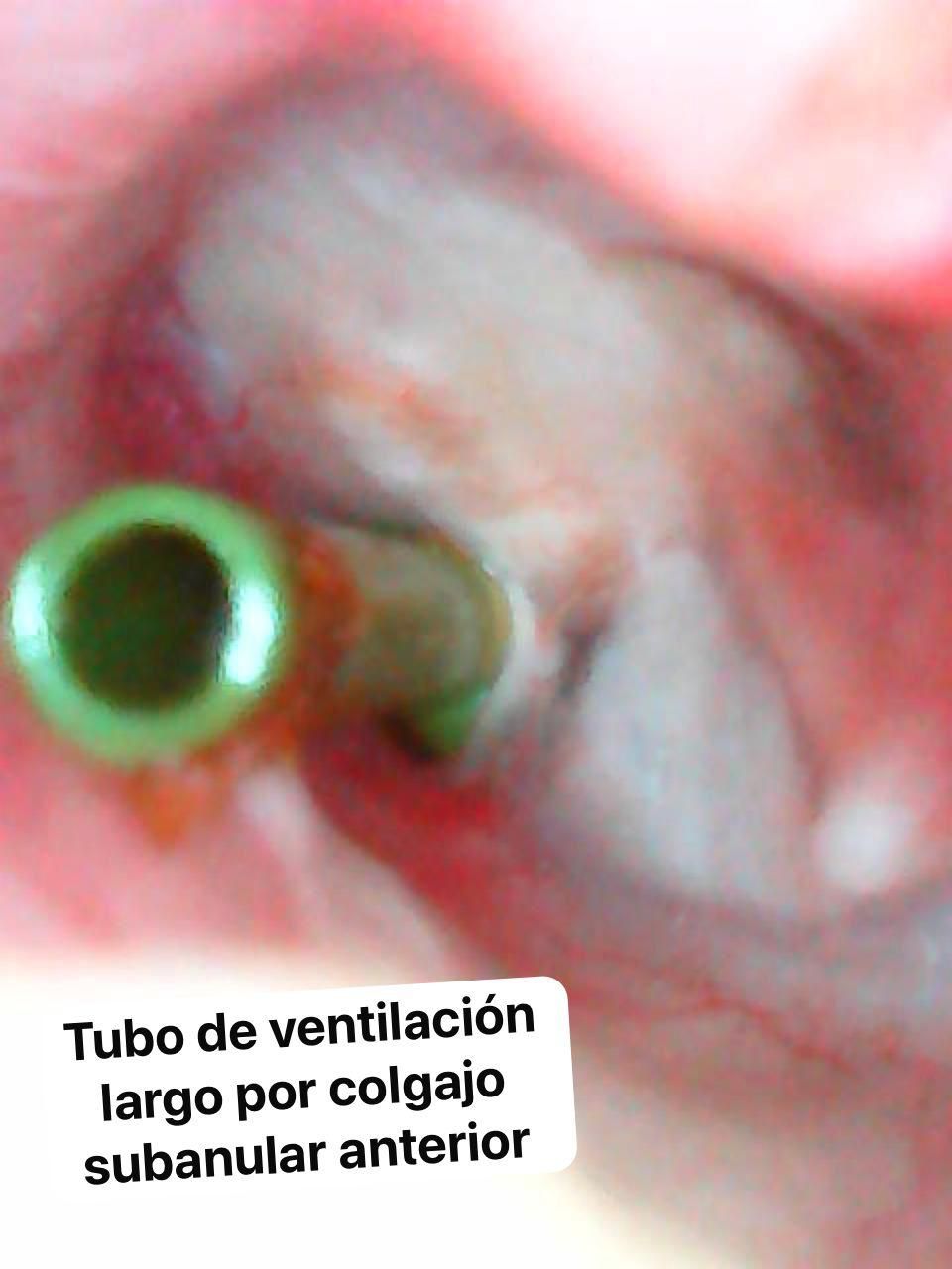 Nuria Esperanza Boronat Echeverria-28