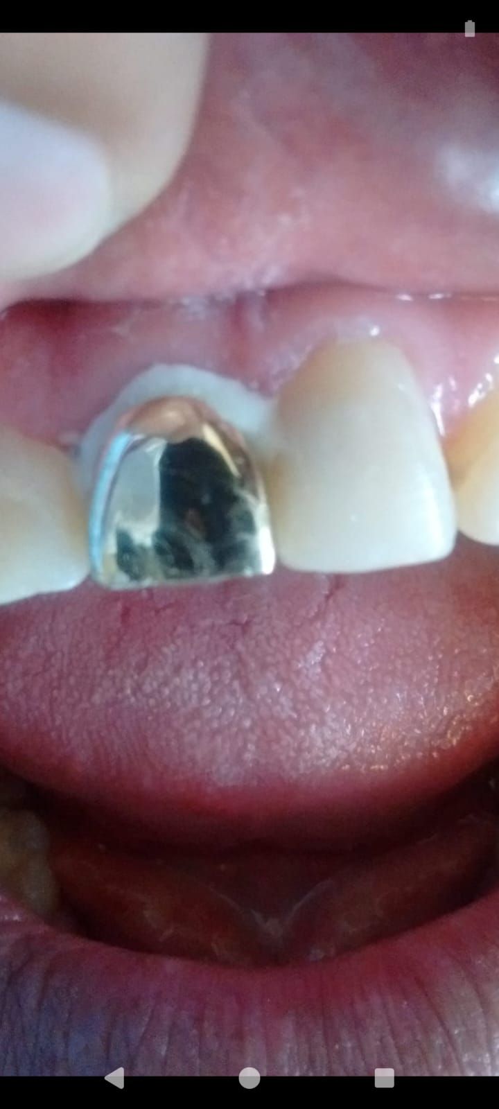 Apolo Espinoza Vega-7