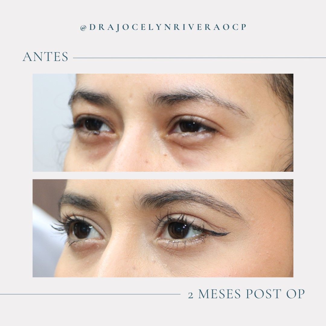 Ivonne Jocelyn Rivera Alvarado-6