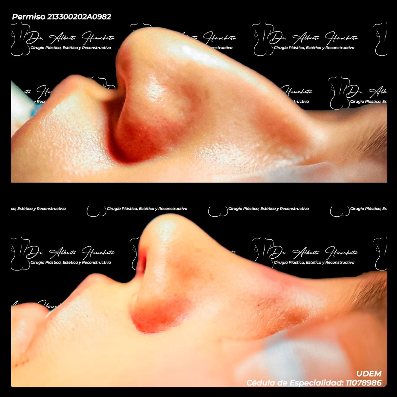 Alberto Hiracheta Torres-23