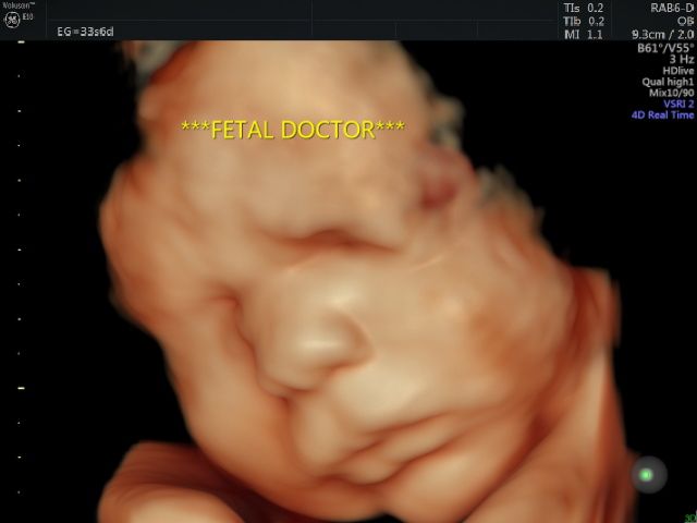 Jesús Manuel Ortega Flores-4