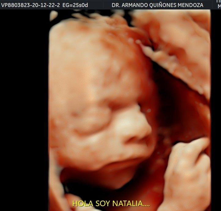 Armando Quiñones Mendoza-6