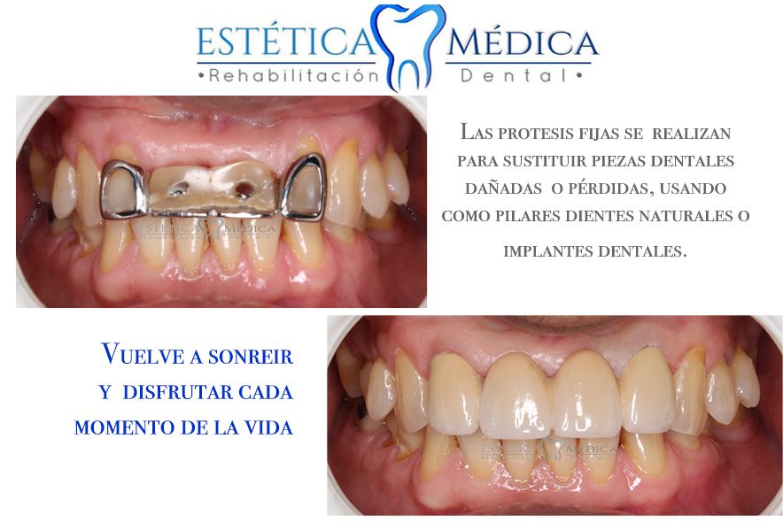 Bielmy Veronica Jonapa Peña-32