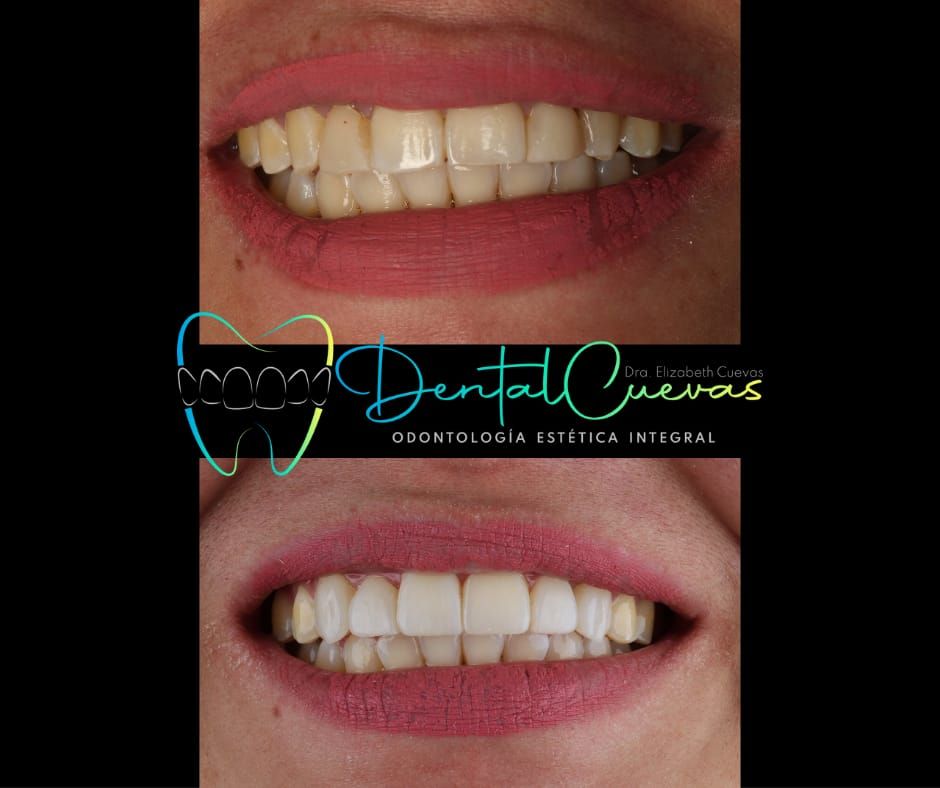 Elizabeth Cuevas Uriostegui-1