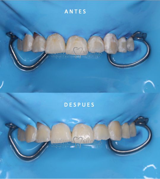 Bielmy Veronica Jonapa Peña-25