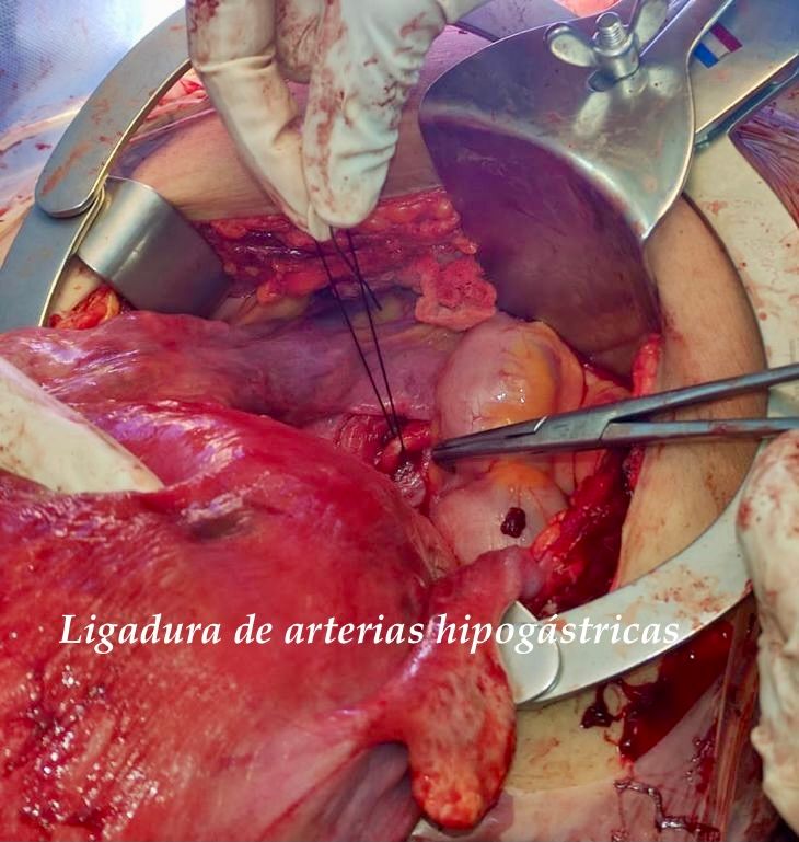 Moises Juda Ramos Abarca-10