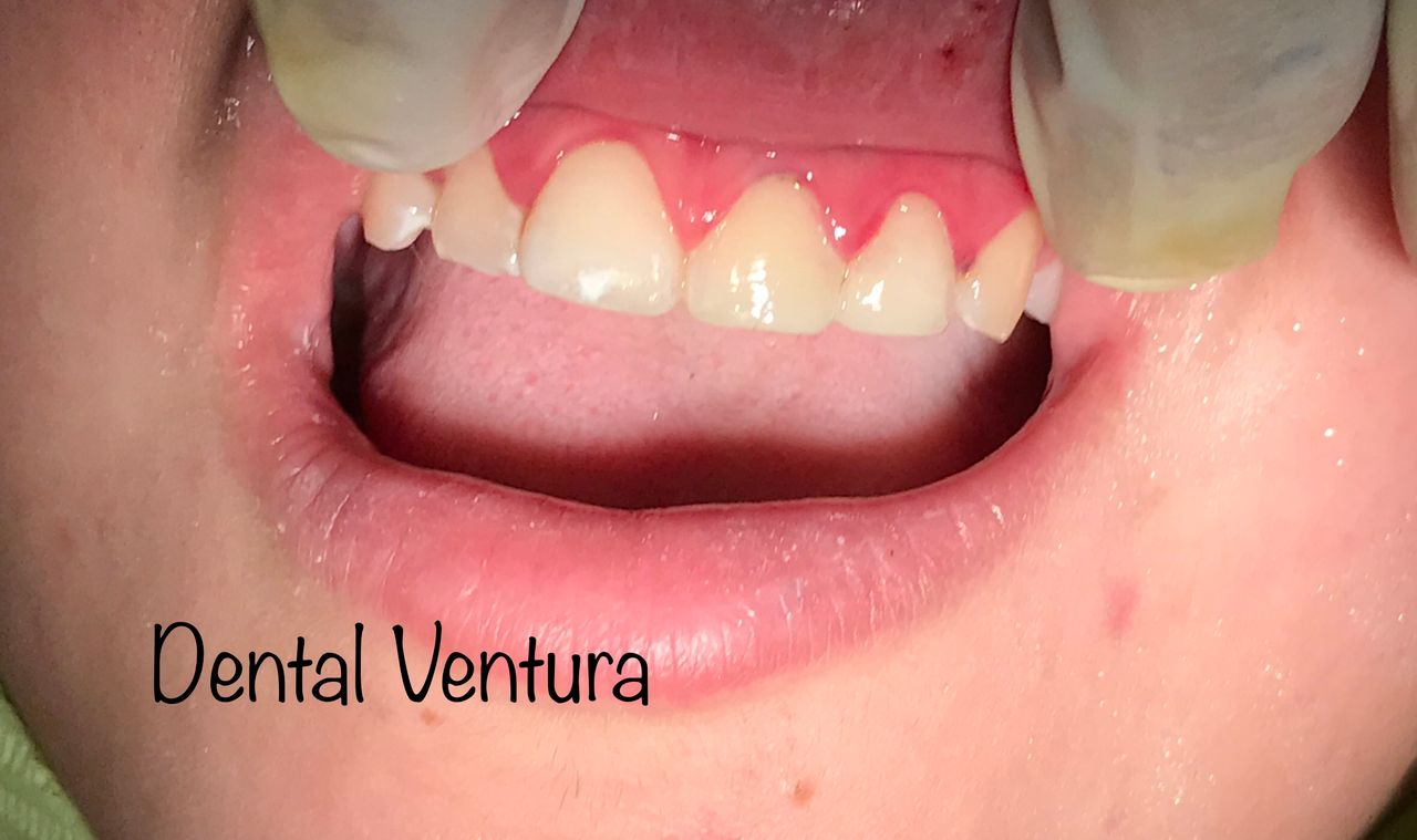 Antonio Cerda Ventura-16