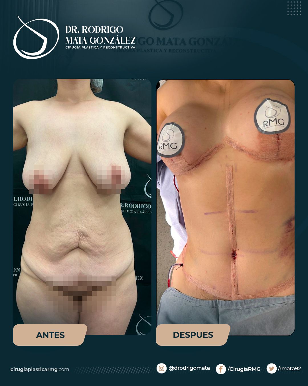 Rodrigo Mata Gonzalez-22