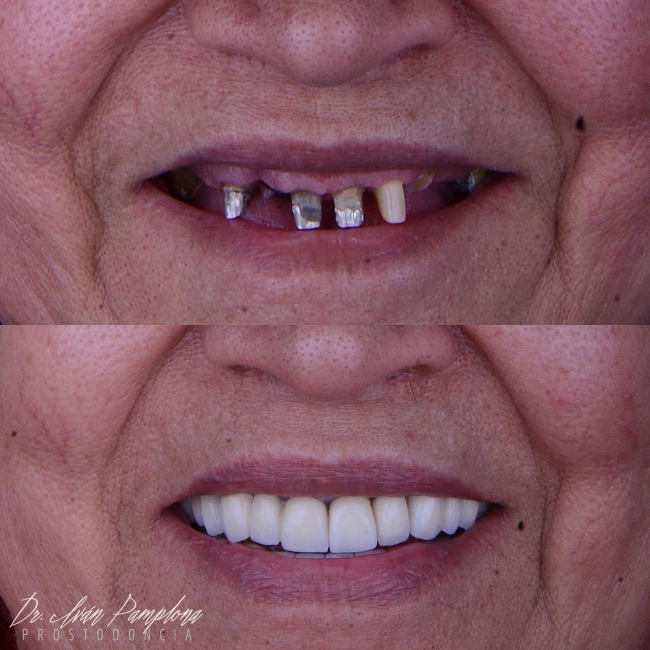 Iván Gerardo Pamplona Alfaro-10