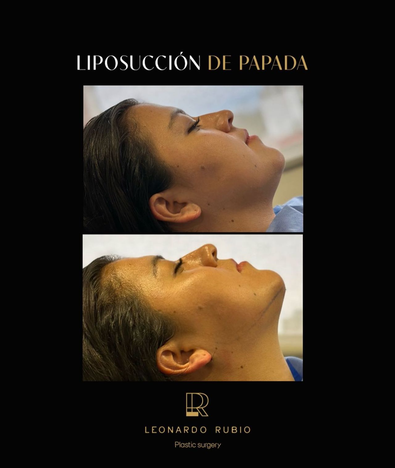 Leonardo Rubio Gomez-7