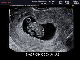 Martha Helena Cabezas Pérez-31