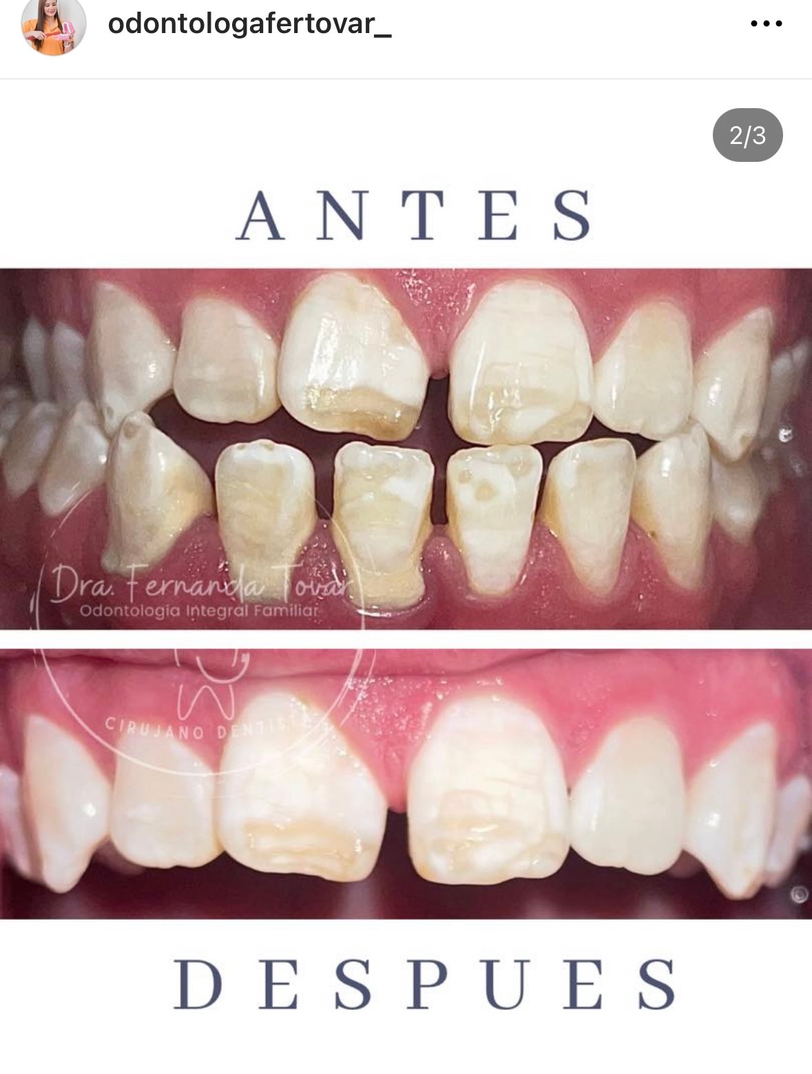 Fernanda Tovar Navarro-5